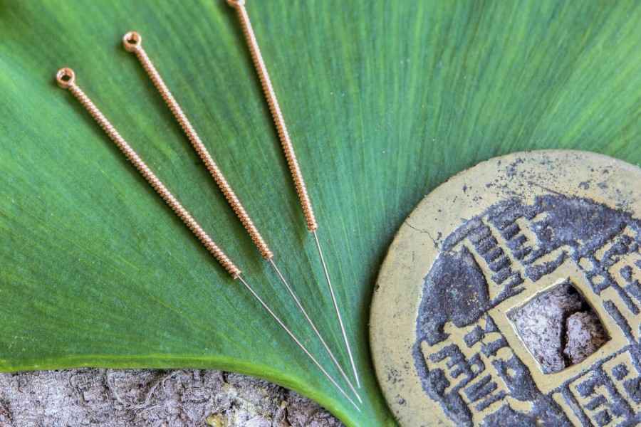 Akupunktur: Was leistet die traditionelle chinesische Heilmethode?