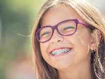 Gothaer MediZ Duo: Ein Mädchen mit Zahnspange lächelt